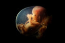 Embrião doado oferece um raro vislumbre do desenvolvimento após a implantação