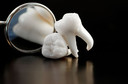 Estudo sugere caminho conectando doença periodontal com artrite reumatoide