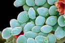 O fungo Candida albicans implanta uma enzima que digere gordura para minar as defesas imunológicas do hospedeiro